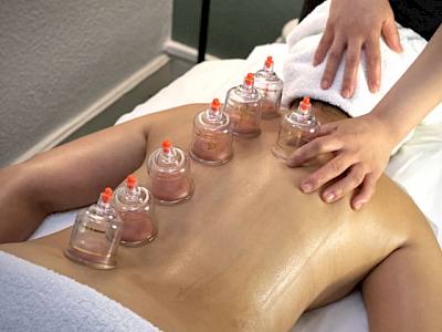 Cupping Therapy